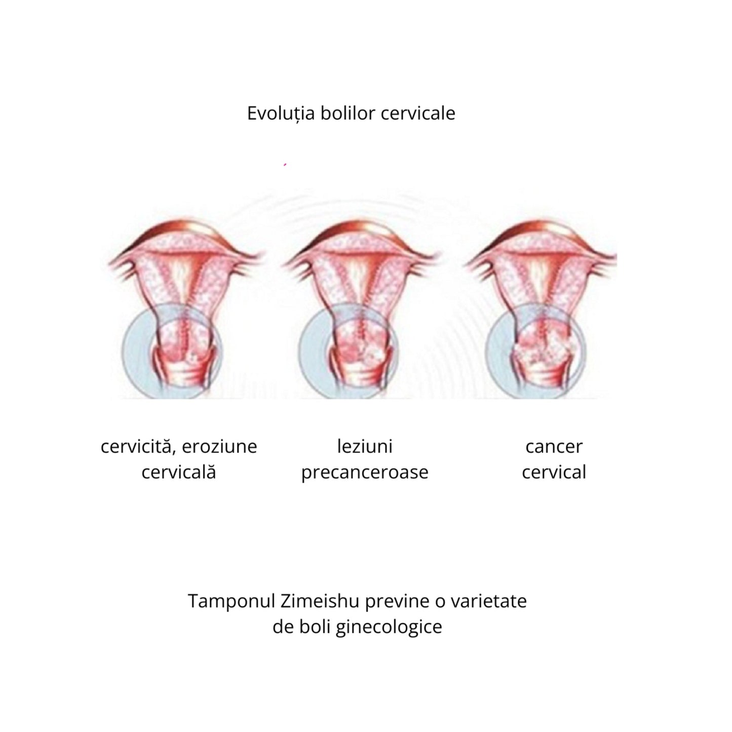 Tampon Zimeishu – 10 bucăți