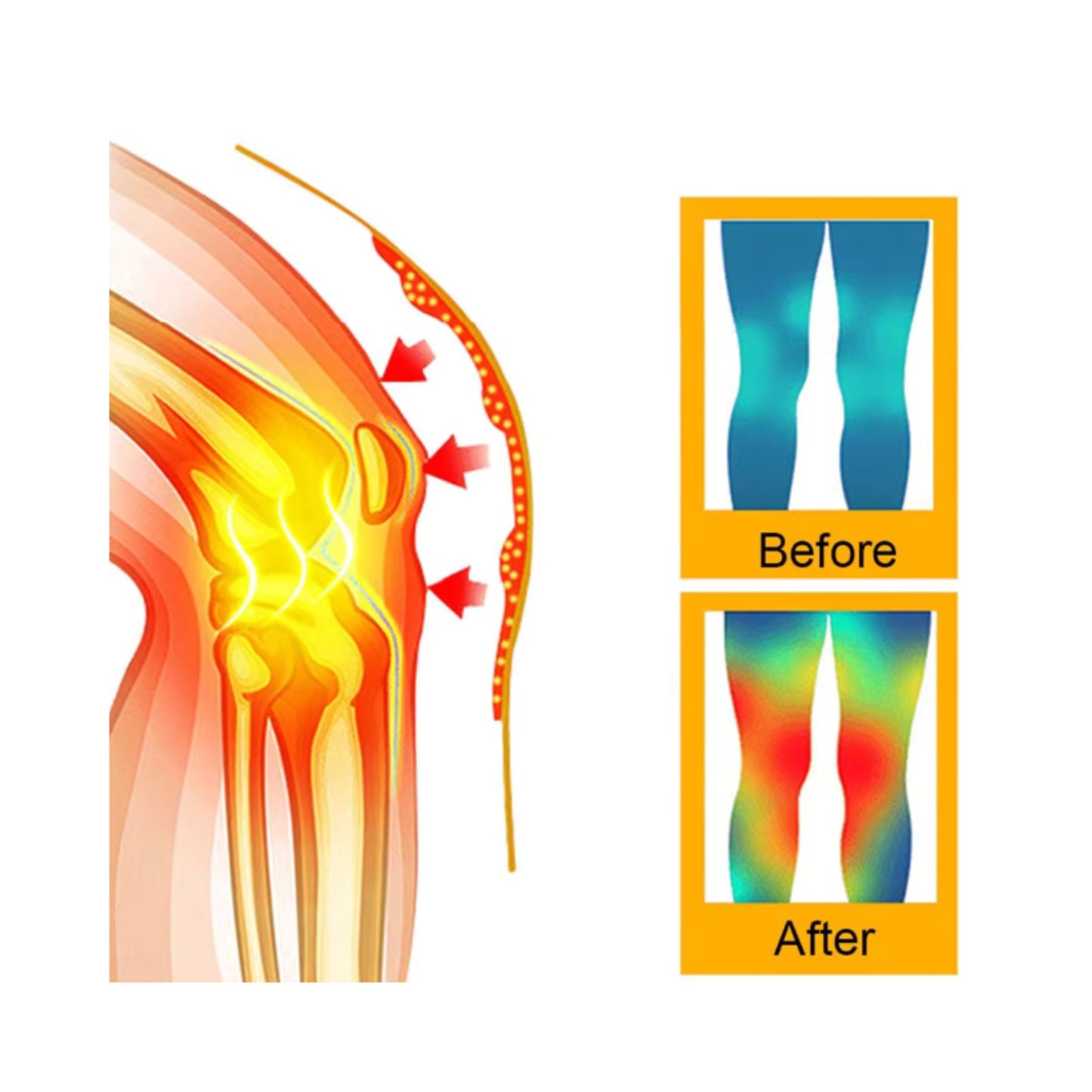 Genunchiere cu turmalină – 2 bucăți